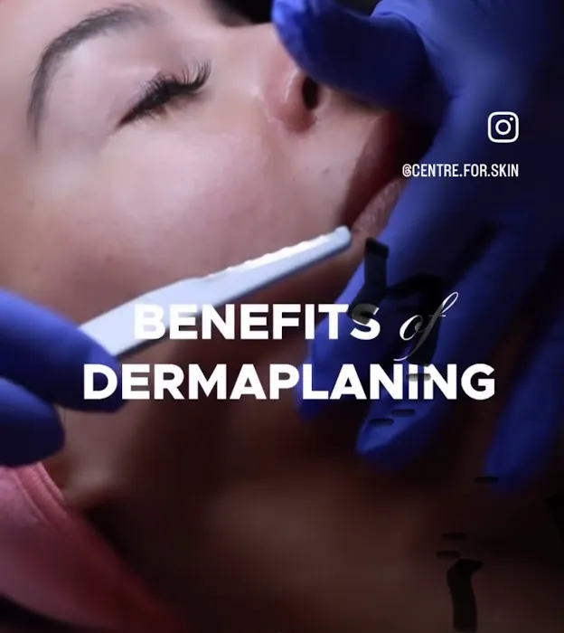 Centre for Skin Picture 4