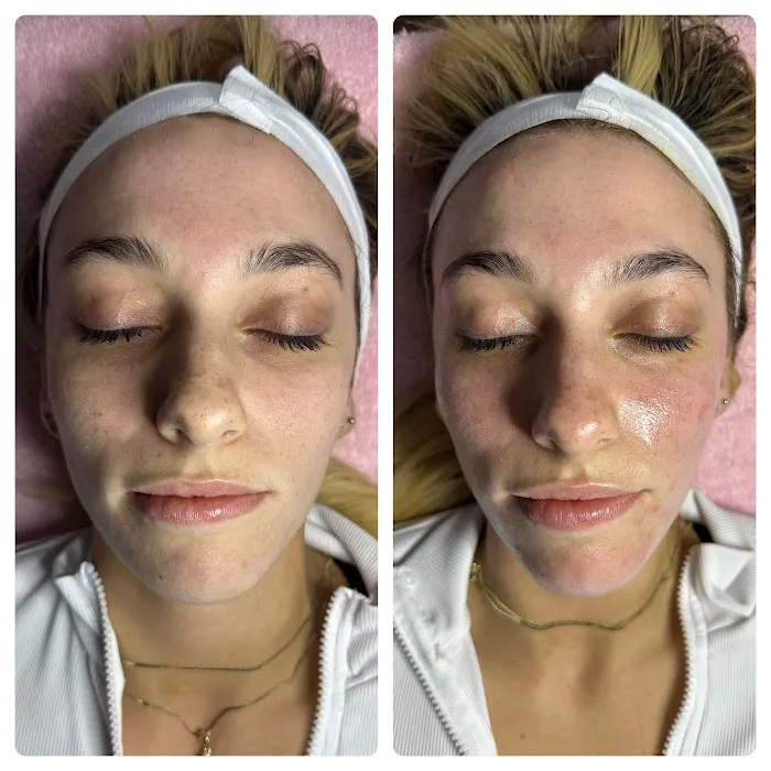 East End Beauty Picture 9