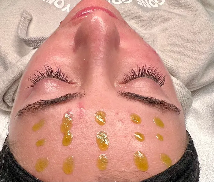 Face by Grace Aesthetics Picture 8