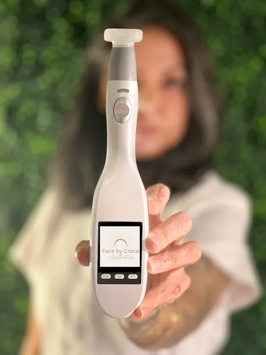 Face by Grace Aesthetics Picture 10