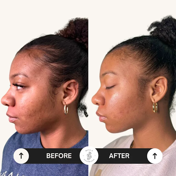 Muva K Aesthetics Picture 7