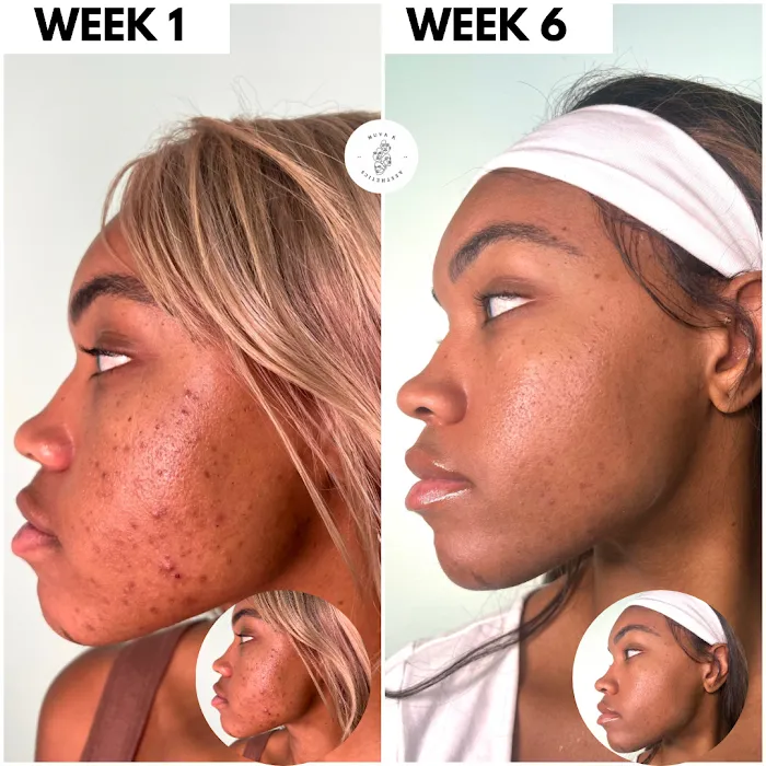 Muva K Aesthetics Picture 6