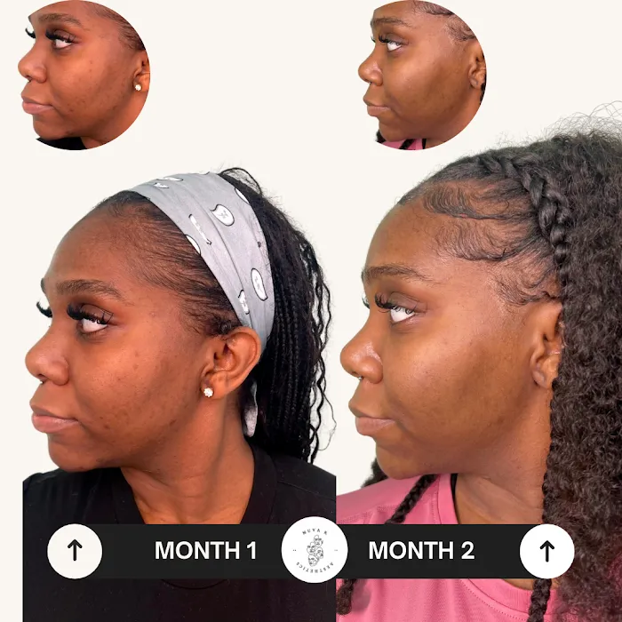 Muva K Aesthetics Picture 9