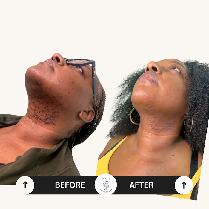 Muva K Aesthetics Picture 4