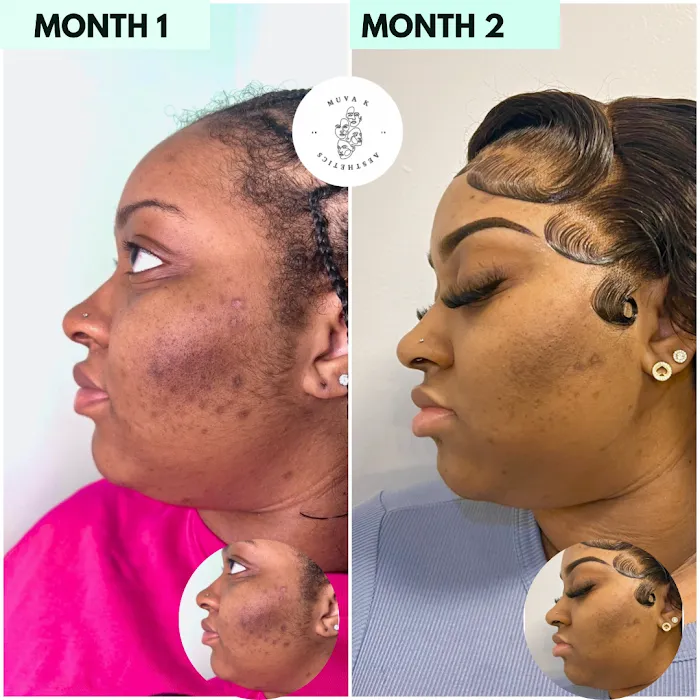 Muva K Aesthetics Picture 10