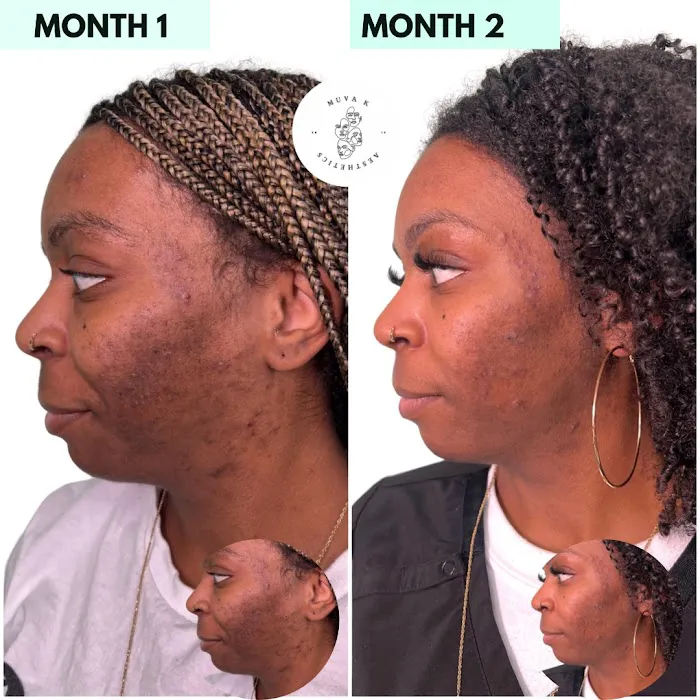 Muva K Aesthetics Picture 2