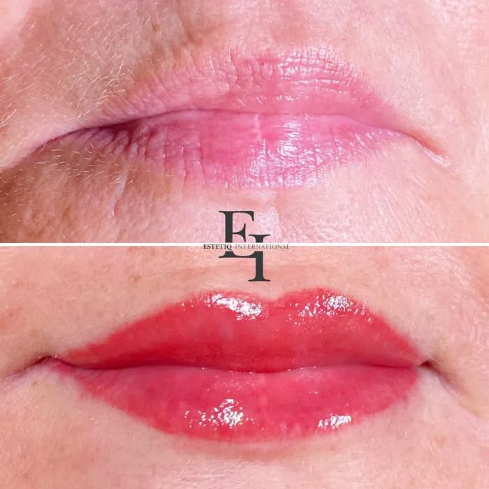 Estetiq International Picture 7