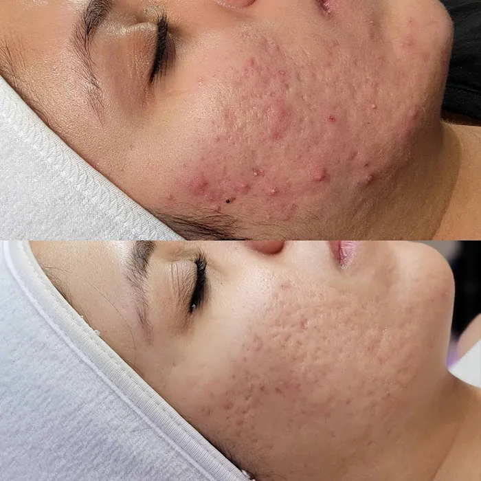 Skin Savi Aesthetics Picture 1