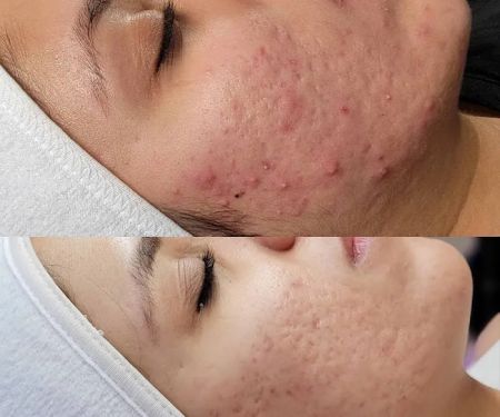 Skin Savi Aesthetics