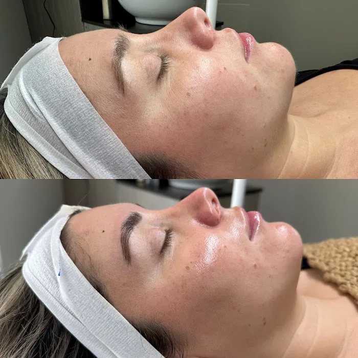 Skin By Brie Picture 1