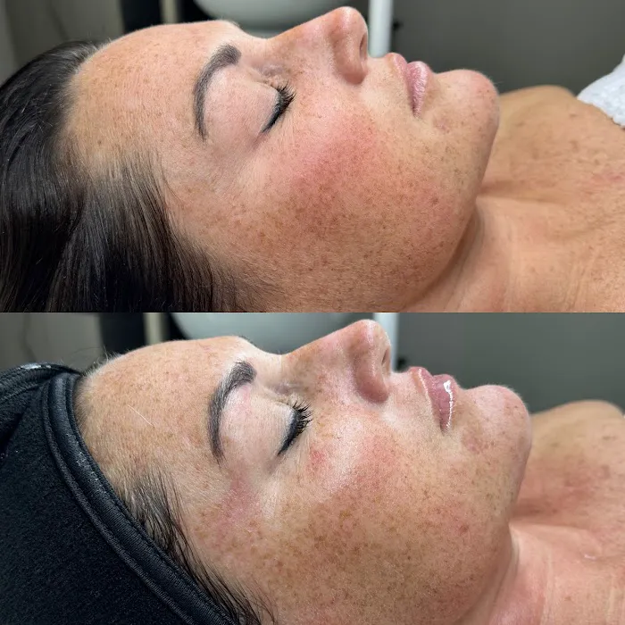 Skin By Brie Picture 8