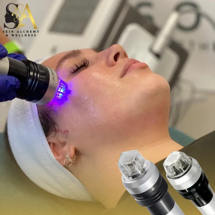 Skin Alchemy & Wellness Picture 5