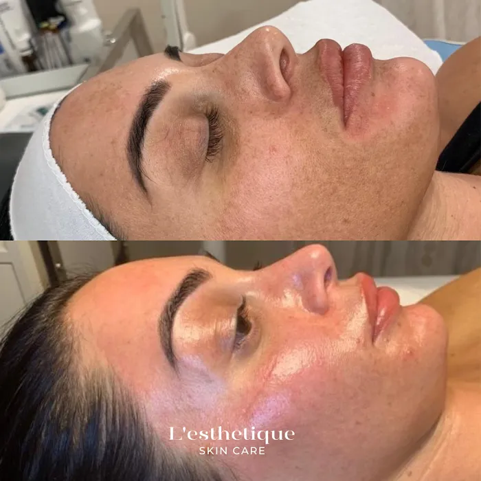 L´esthetique Skin Care Picture 10