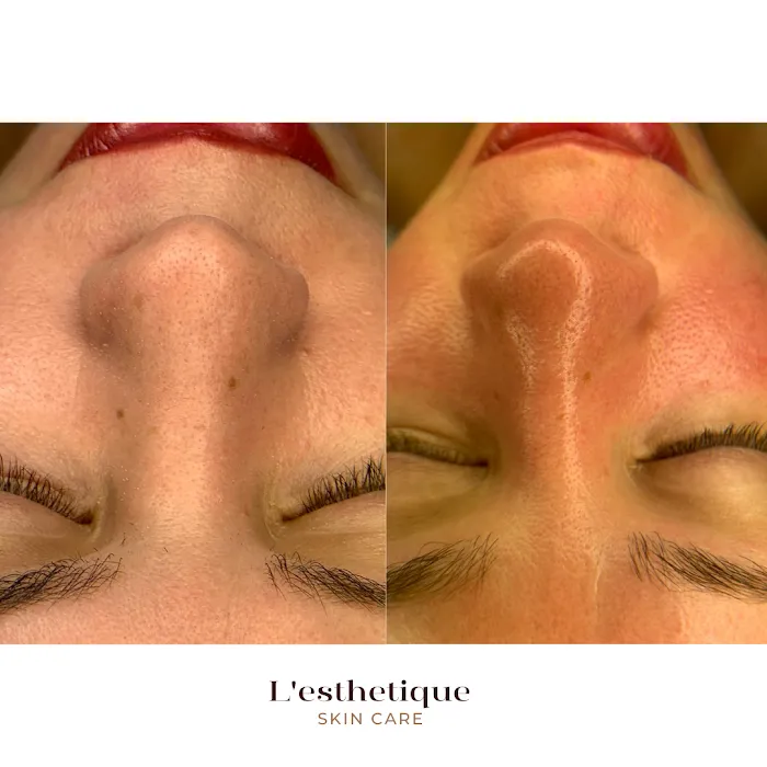 L´esthetique Skin Care Picture 7