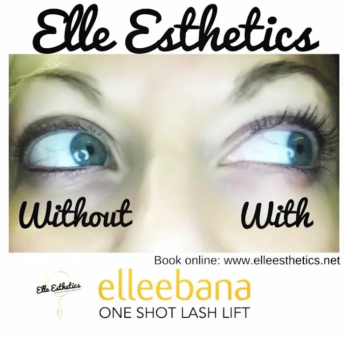 Elle Esthetics, LLC Picture 6