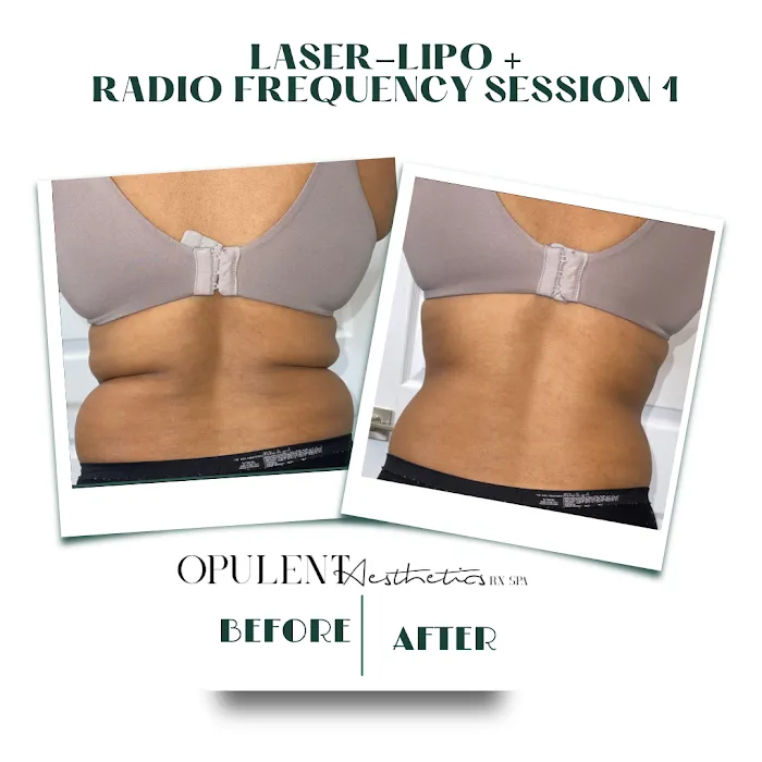 Opulent Aesthetics Rx Picture 3