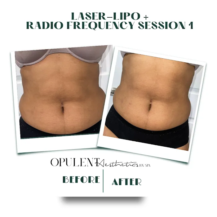 Opulent Aesthetics Rx Picture 2