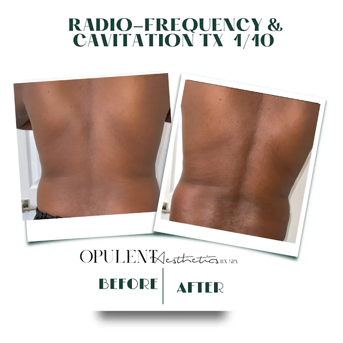 Opulent Aesthetics Rx Picture 4