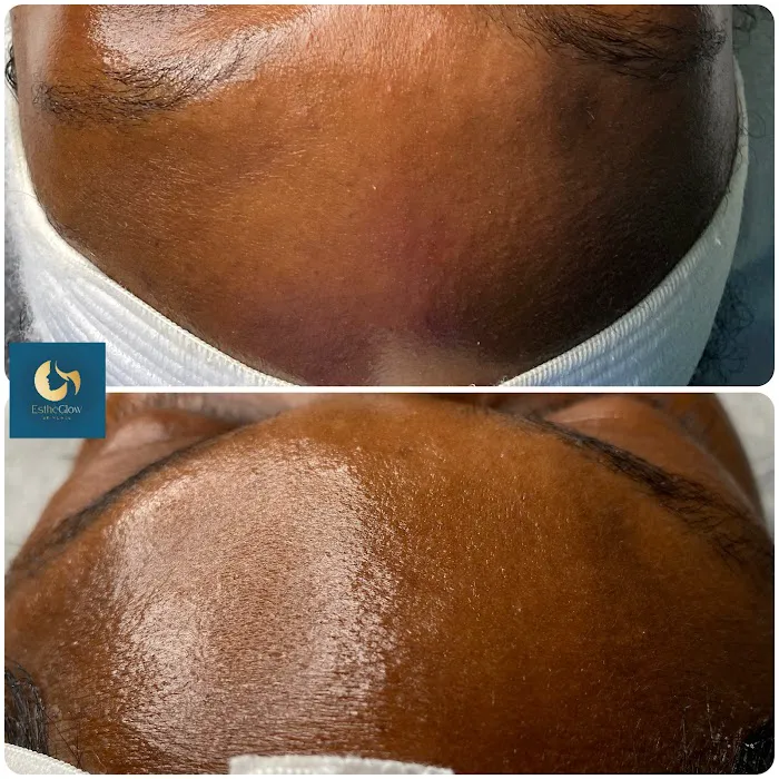 EstheGlowspa Picture 5