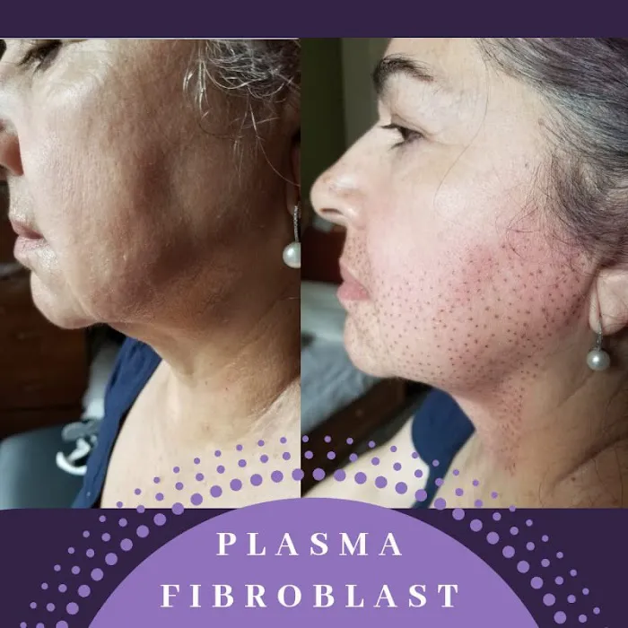 Skin and art Picture 2