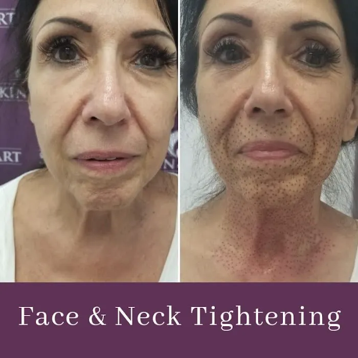 Skin and art Picture 8