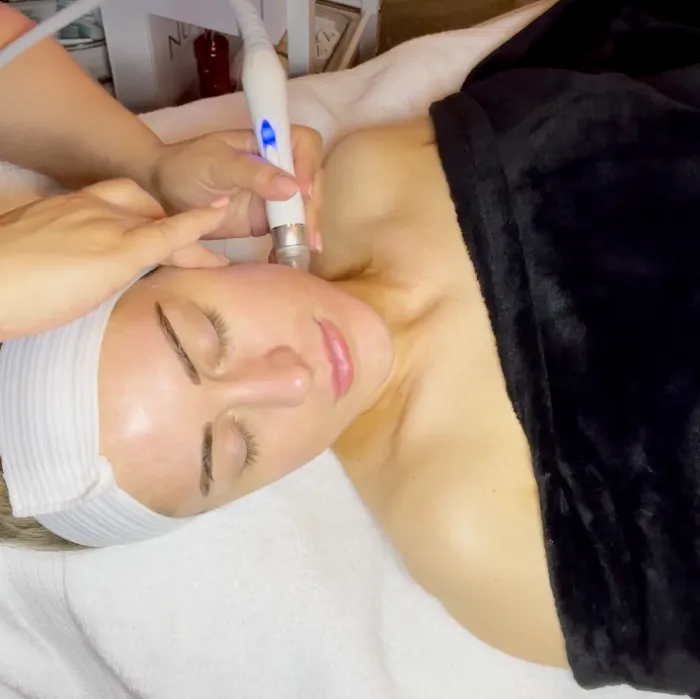 Bareface Esthetics LLC Picture 4