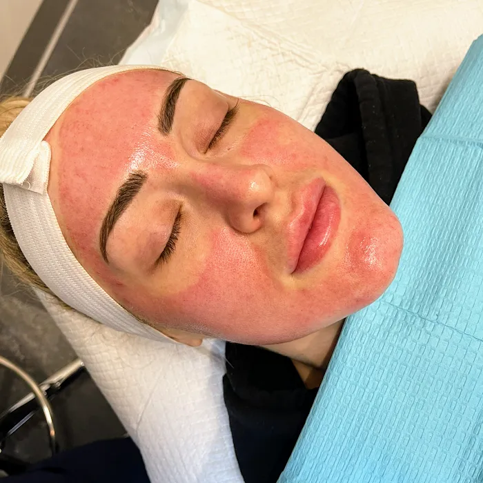 Bareface Esthetics LLC Picture 8