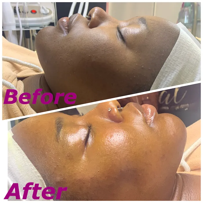 BareFace Aesthetics - Facial Spa & Skin Treatment Picture 9
