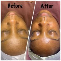 BareFace Aesthetics - Facial Spa & Skin Treatment ico