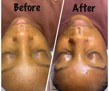 BareFace Aesthetics - Facial Spa & Skin Treatment