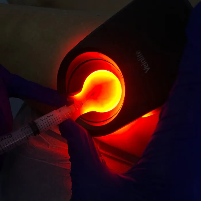 AQUA Vein Center at Water's Edge Dermatology - West Palm Beach Picture 5