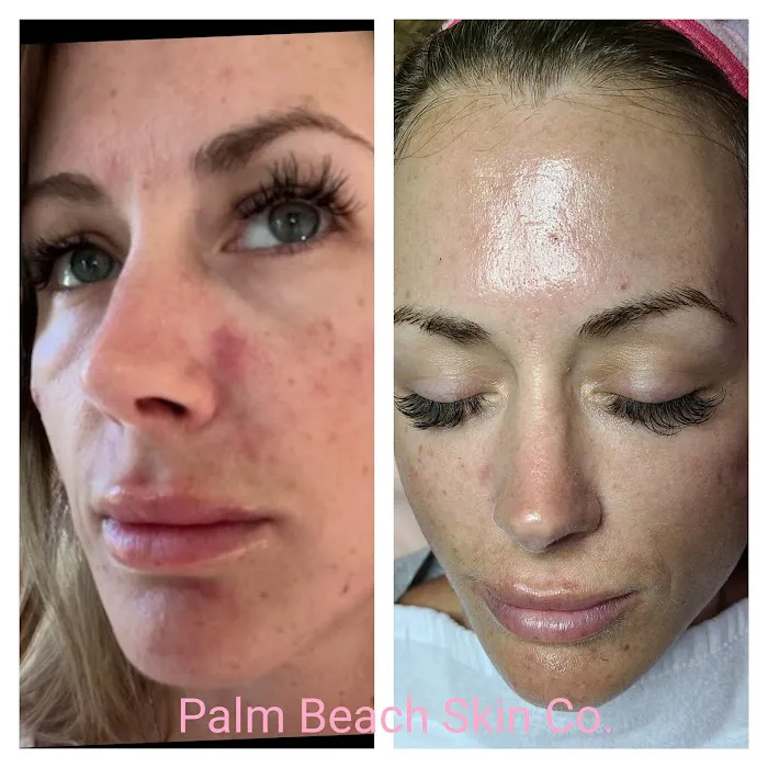 Palm Beach Skin Co. Picture 7