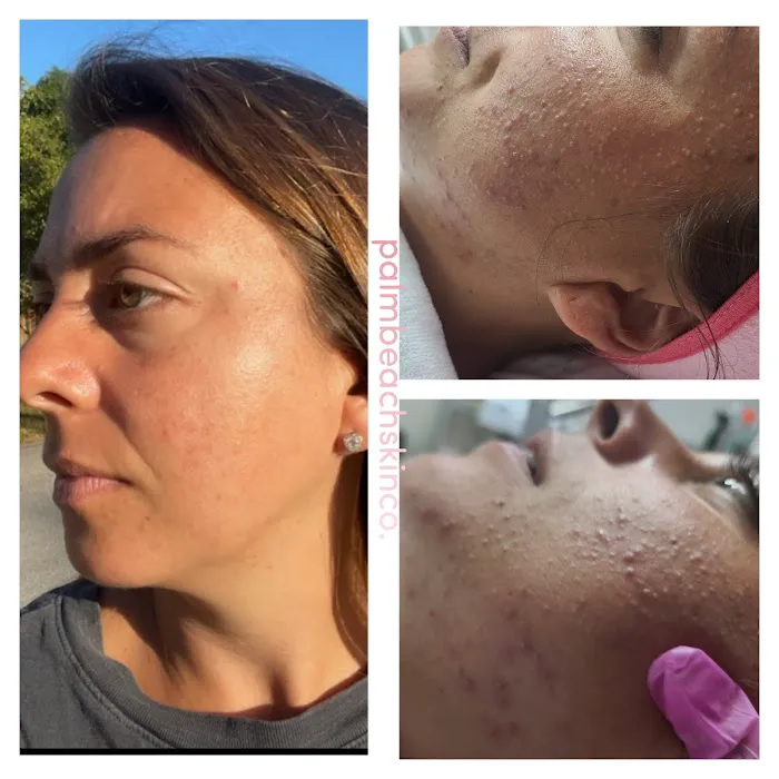 Palm Beach Skin Co. Picture 5