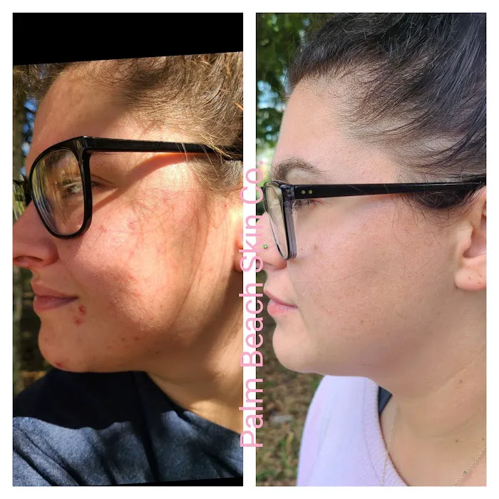 Palm Beach Skin Co. Picture 2