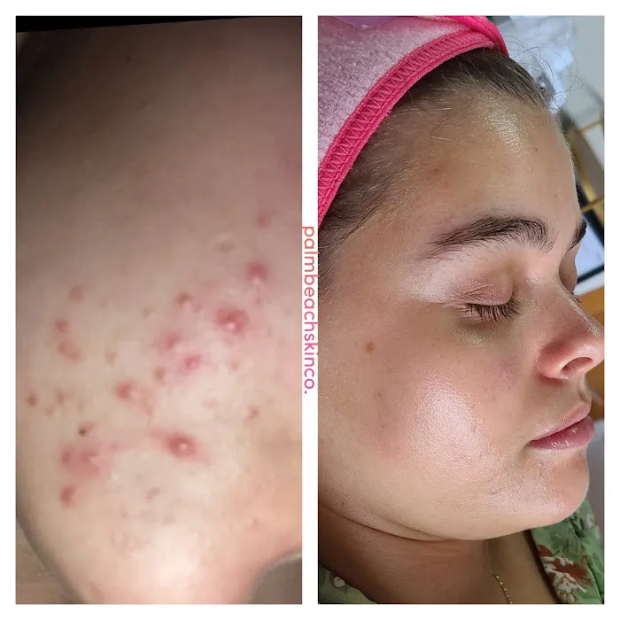 Palm Beach Skin Co. Picture 8