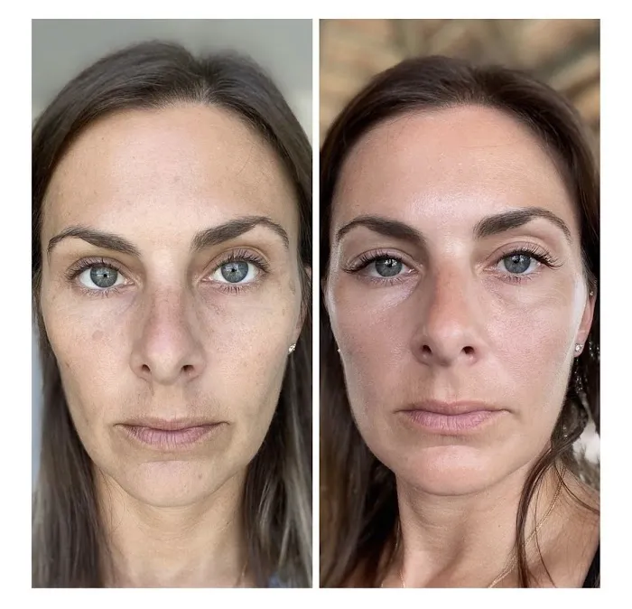 Sklo Aesthetics Picture 10