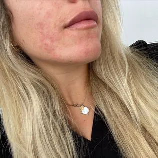 Sklo Aesthetics Picture 9