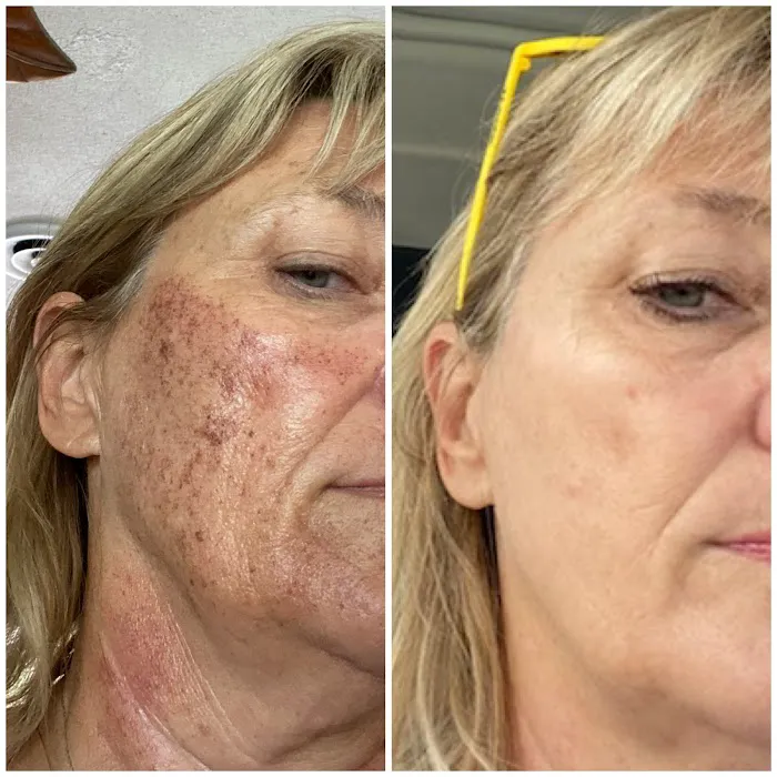 Steuben Skincare/North Palm Beach Aesthetics Picture 6