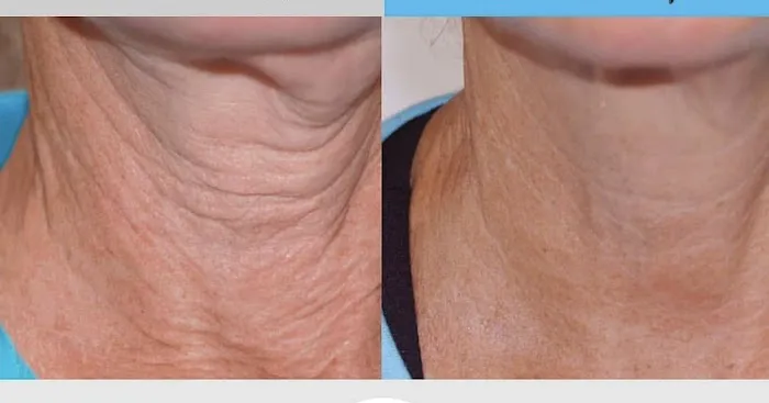 Liz OConnor Permanent Makeup & Esthetics Picture 1