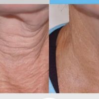 Liz OConnor Permanent Makeup & Esthetics ico