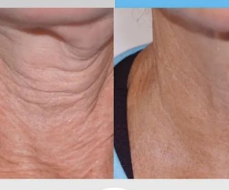 Liz OConnor Permanent Makeup & Esthetics