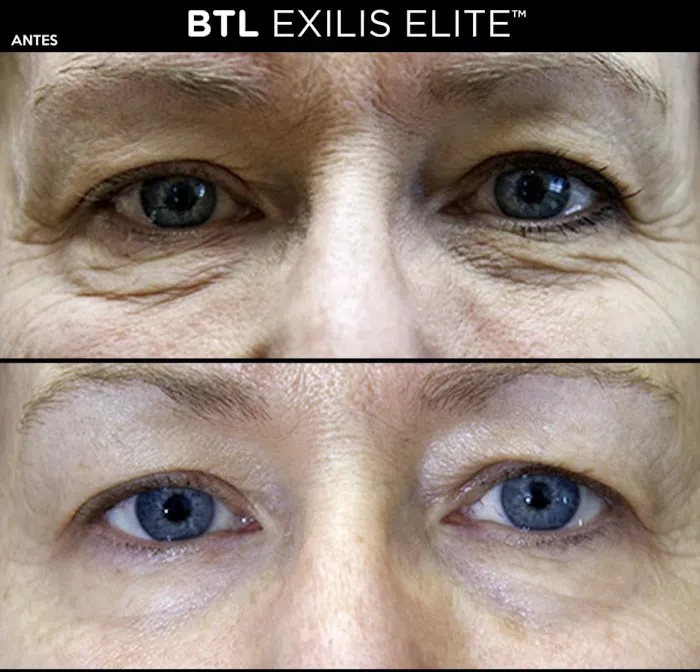 Liz OConnor Permanent Makeup & Esthetics Picture 2