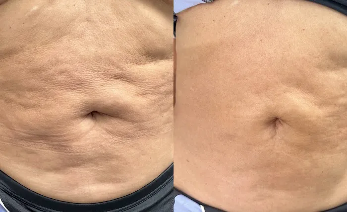 Skin I.D. Aesthetics Picture 3