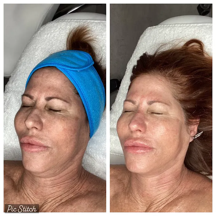 Palm Beach Aesthetics Picture 9