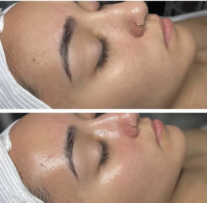 Palm Beach Aesthetics Picture 2