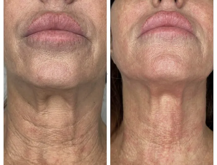 Palm Beach Aesthetics Picture 5