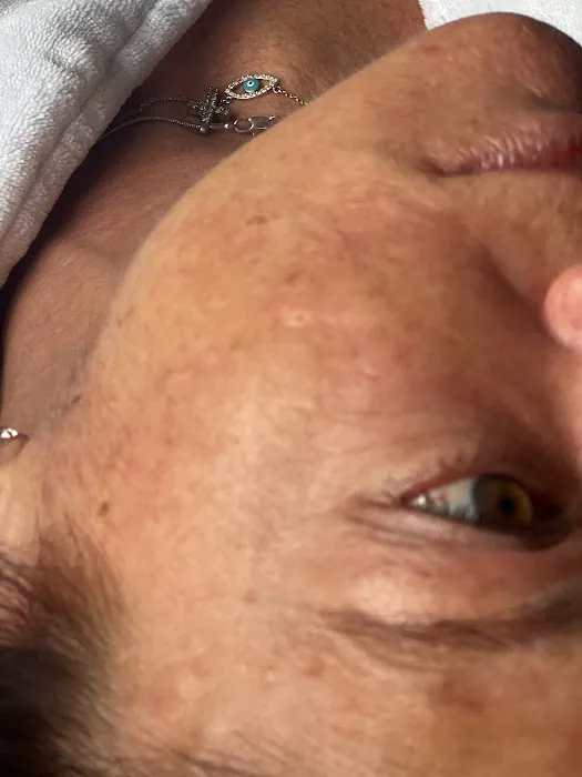 Palm Beach Aesthetics Picture 4