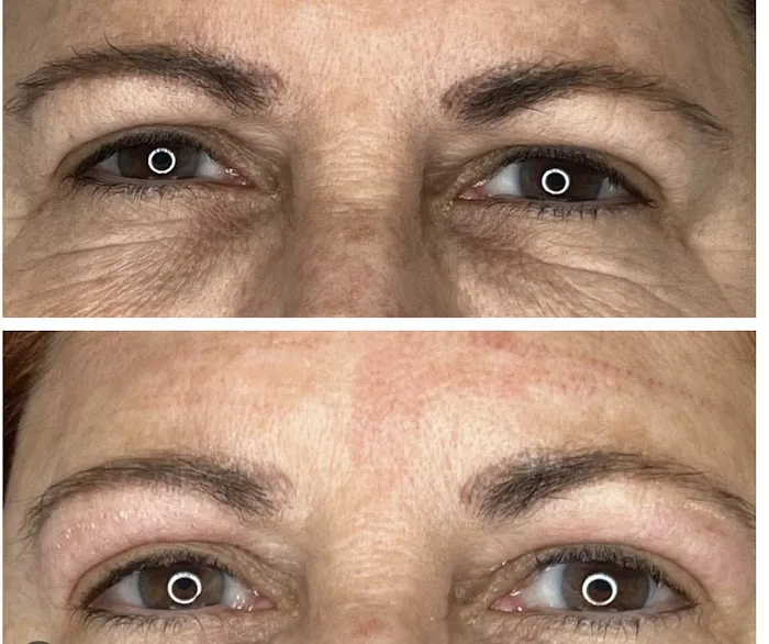 Palm Beach Aesthetics Picture 10