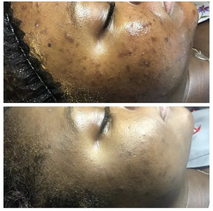 Luna Bella Skin Care Picture 10