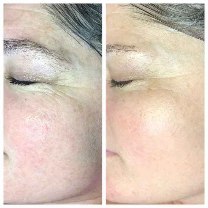 Luna Bella Skin Care Picture 8